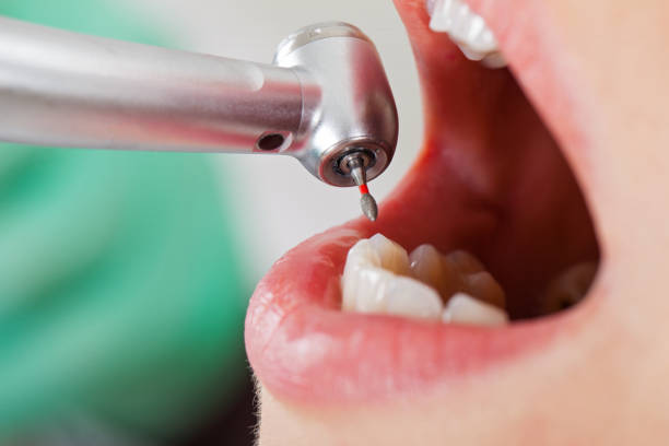 Best Emergency Dentist Near Me  in Purcell, OK